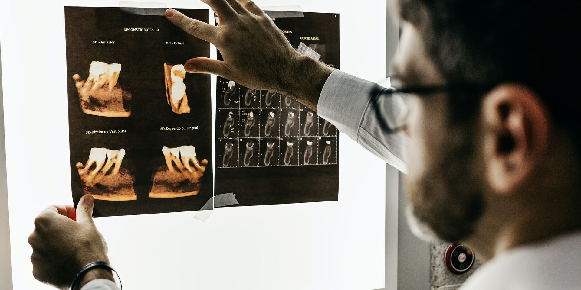 endodontics-inurance